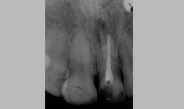 Dental care in Anand
                        